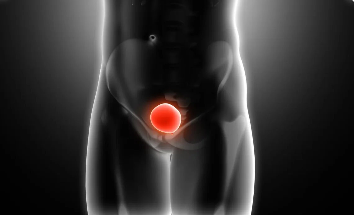 Cistitis en Adultos Mayores: Posible Indicador Temprano de Cáncer Urogenital