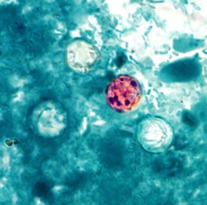 Investigación de los CDC por brote de Cyclospora con más de 400 casos en 18 estados de EE. UU.