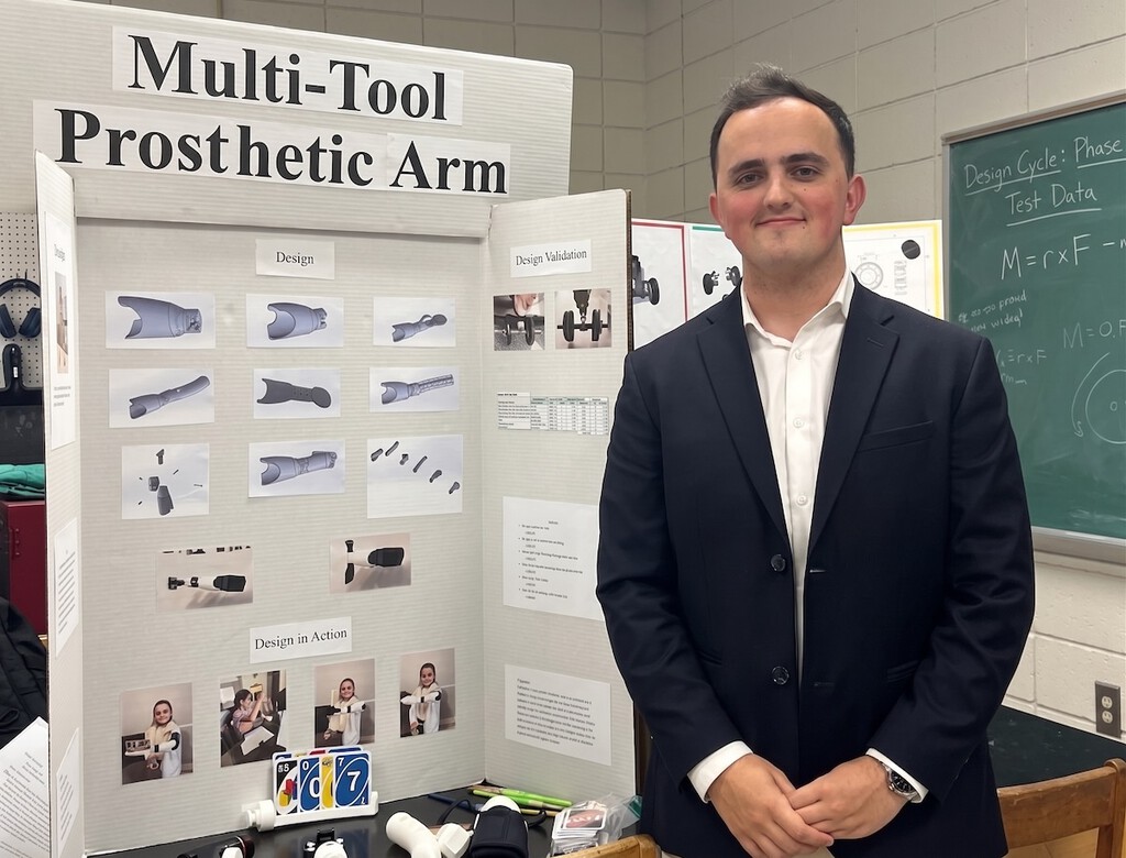 Estudiante de ingeniería crea prótesis de brazo multifuncional para su hermana
