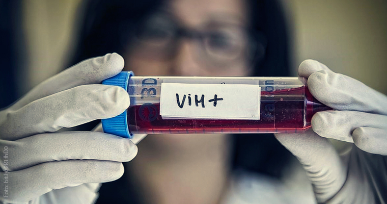 Nuevo Enfoque Integral Disminuye Drásticamente la Mortalidad por VIH