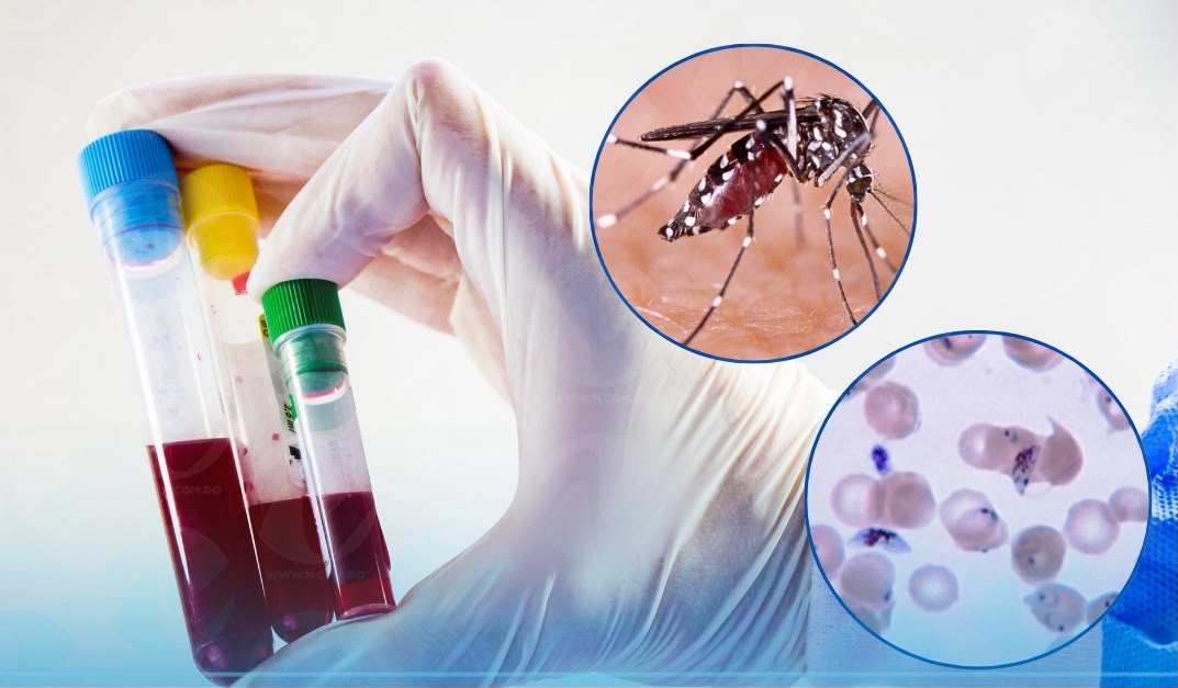 República Dominicana Registra 338 Casos de Dengue y 137 de Malaria en 2026